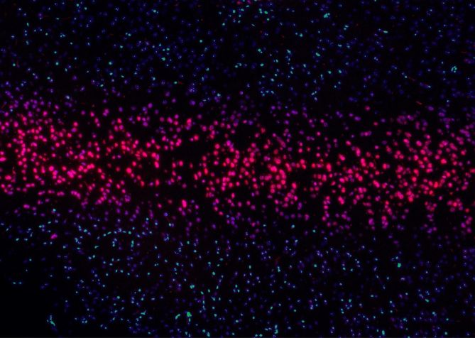 Determining patient prevalence with rare and ultra-rare diseases will help to build your gene therapy value story 